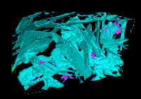 Focused Ion Beam